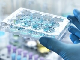 新时空丨“前辈”被强制退市，“胃癌筛选第一股”MIRXES-B(02629.HK)年内股价跌幅近70%