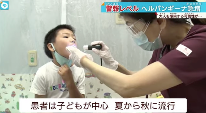 东京大阪发布警报！超万名儿童中招，疱疹性咽峡炎等传染病强势来袭