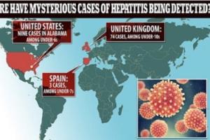 欧美幼童爆发“神秘肝炎”！世卫组织和美国疾控中心正展开调查